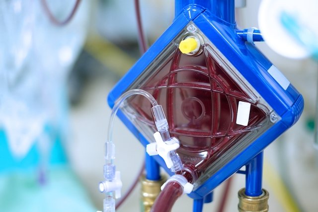 O que é a ECMO