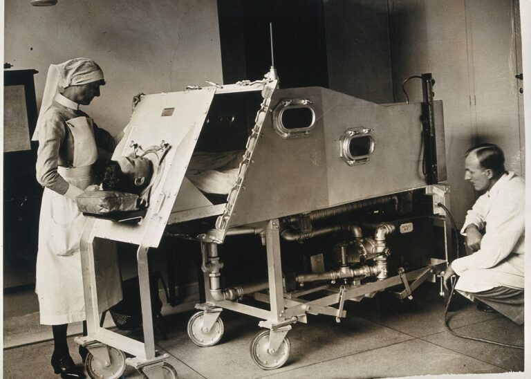 Fotografia antiga da história da medicina intensiva mostrando um paciente dentro de um respirador mecânico negativo chamado pulmao de ferro observado por uma enfermeira de pé e um médico sentado